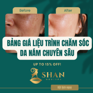 Bang Gia Lieu Trinh Cham Soc Da nam Chuyen Sau shan medi spa